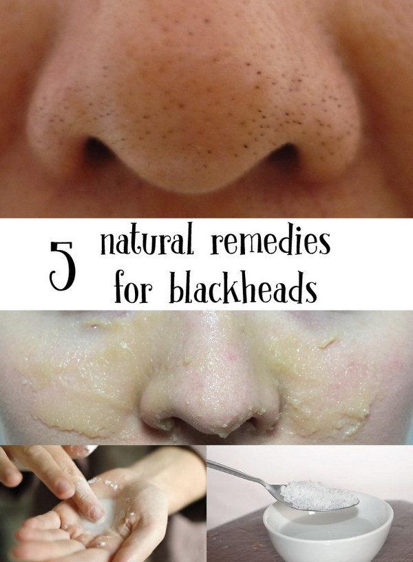 Homemade Blackheads Remover Tutorials And Ideas 2022