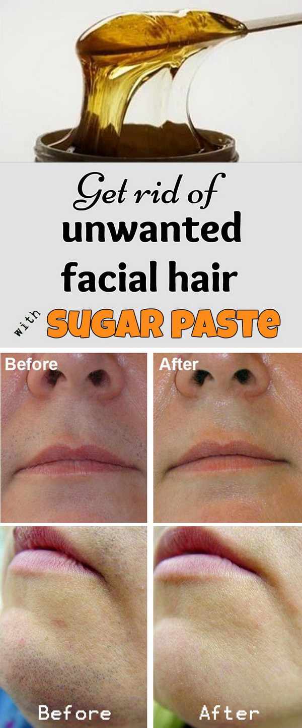 Get Rid of Unwanted Facial Hair With Sugar Paste. 