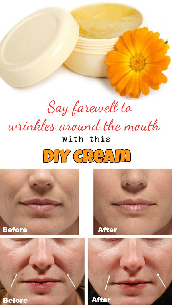 Say Farewell to Wrinkles Around The Mouth With This DIY Cream. 