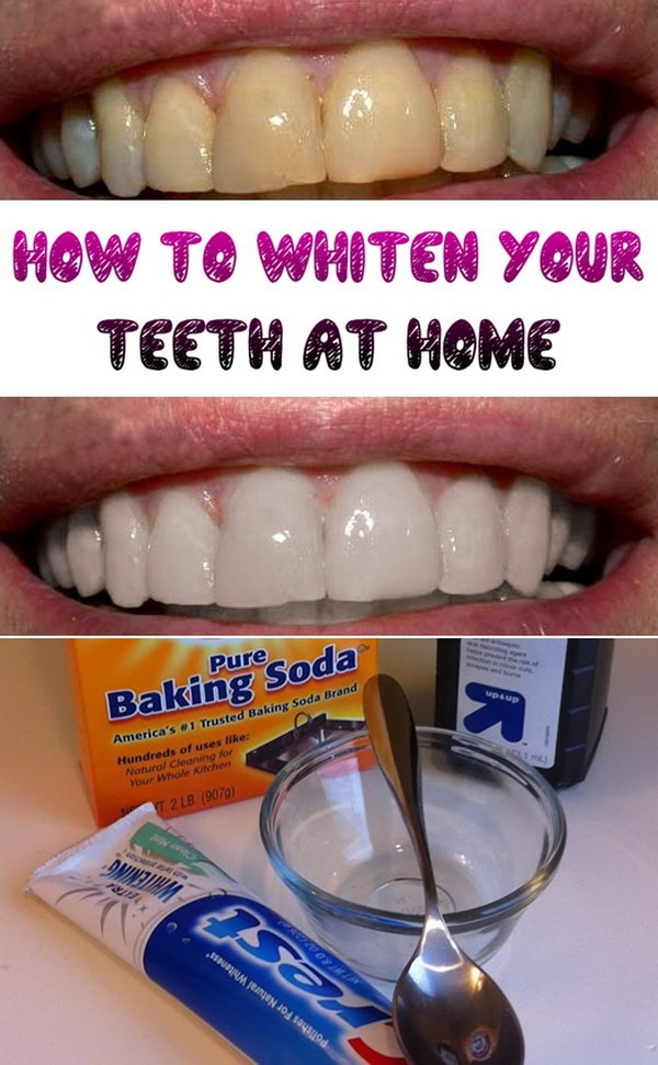 15 Natural Ways to Whiten Your Teeth: Homemade Teeth 