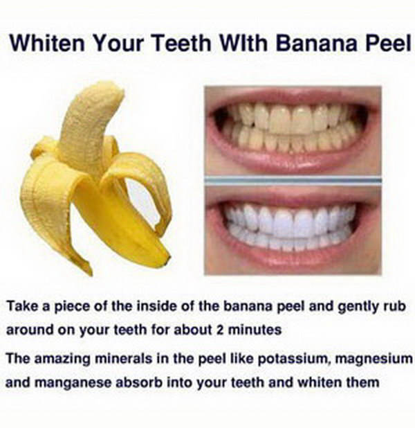 15 Natural Ways To Whiten Your Teeth Homemade Teeth Whiteners 2017