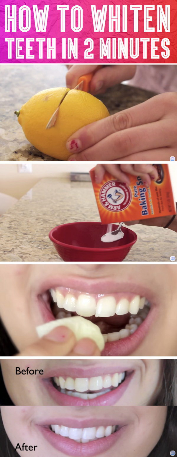 Trick To Whiten Teeth In 2 Minutes. 