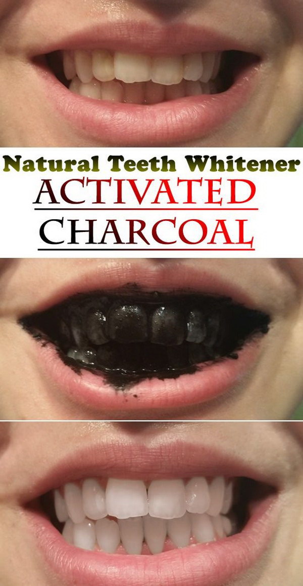 Natural Teeth Whitener with Activated Charcoal. 