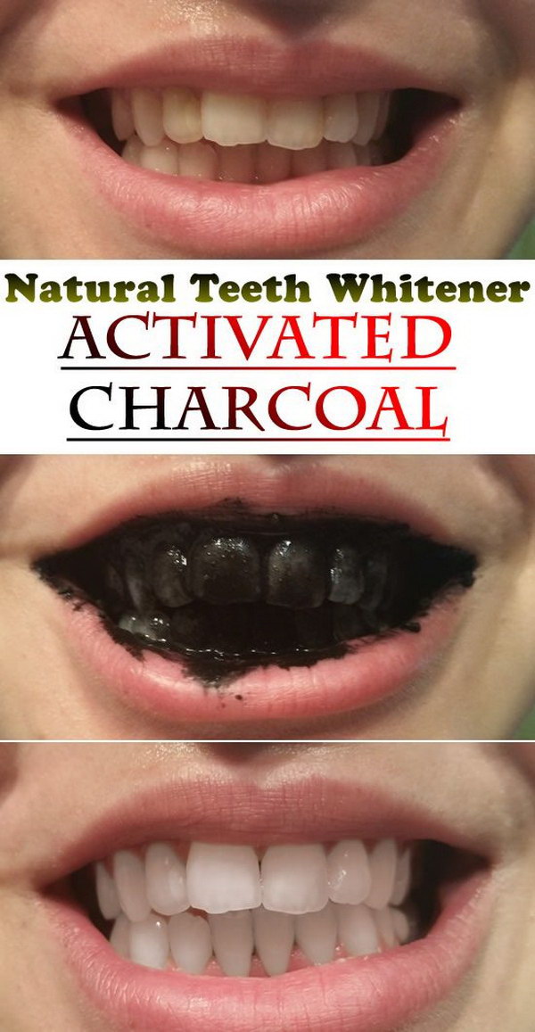 Instructions for teeth whitening at home