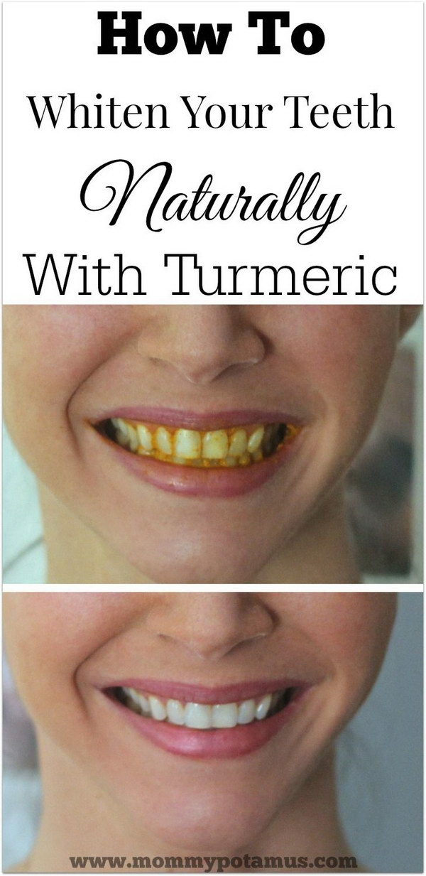 How To Whiten Teeth Naturally With Turmeric. 